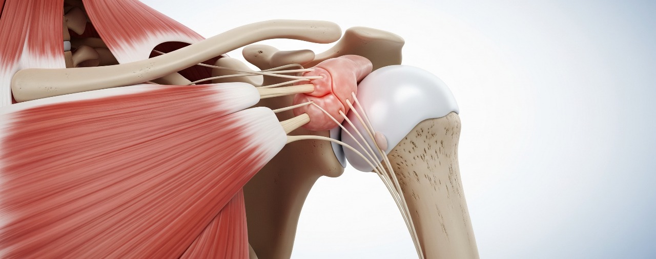 Impingement Syndrome
